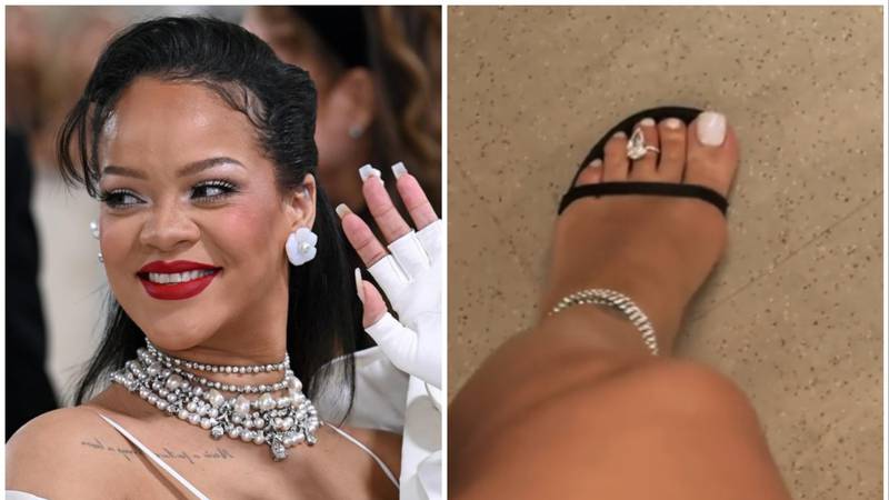 Rihanna je natečena trudnička stopala ukrasila dijamantima…