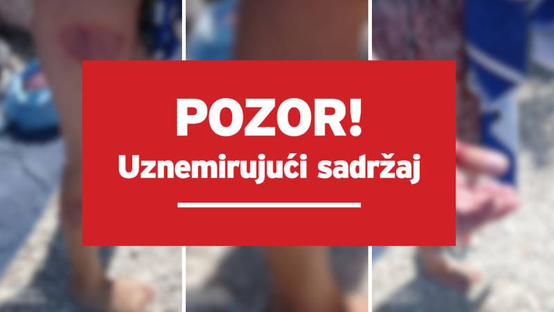 Novi napad kornjače na Čiovu: ‘Agresivno je plivala, žena je u šoku, cijela noga joj je krvava’