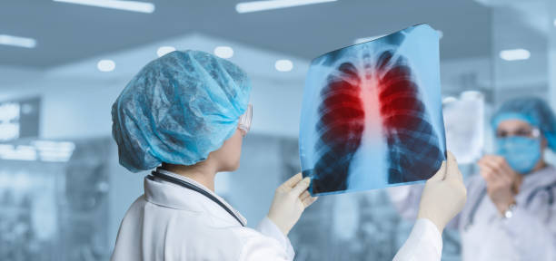 Pobliže o upali pluća: identifikacija ključnih simptoma