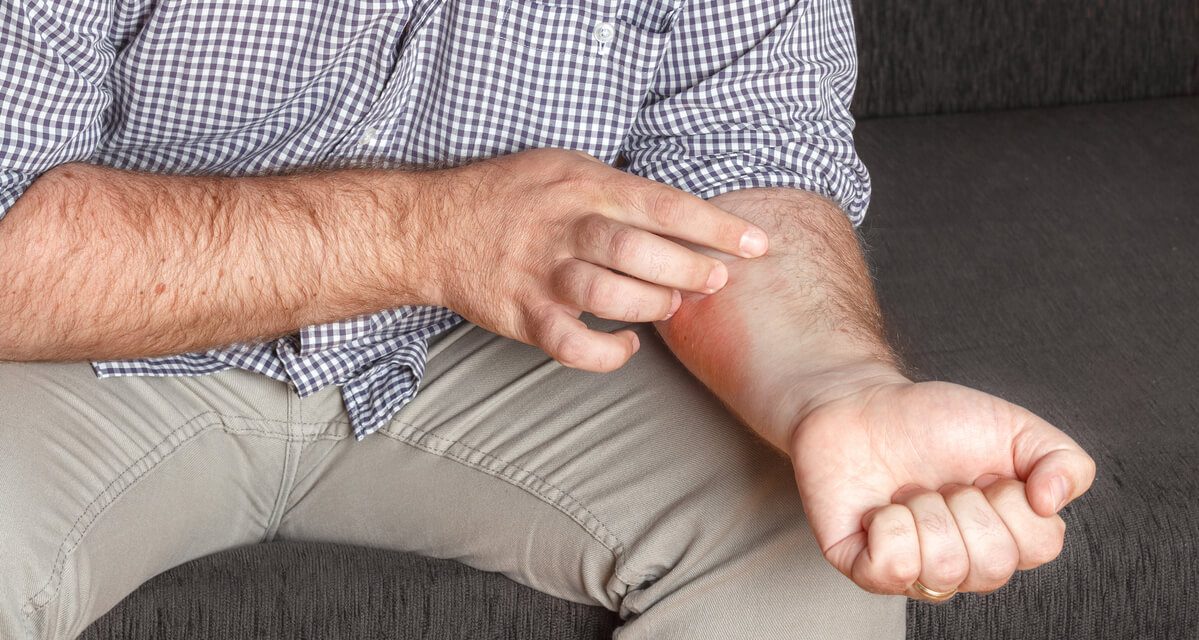 Da li psorijaza svrbi kod svih pacijenata i kako se nositi s tim simptomom?