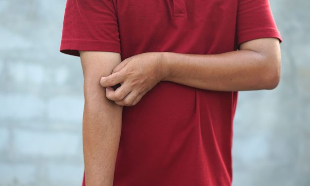 Načini prijenosa svraba