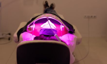 Estetski tretmani bez oporavka: kako danas izgleda moderno pomlađivanje lica